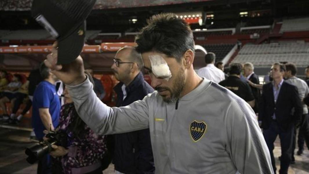 Pablo Perez ferito all'occhio dopo l'assalto al bus