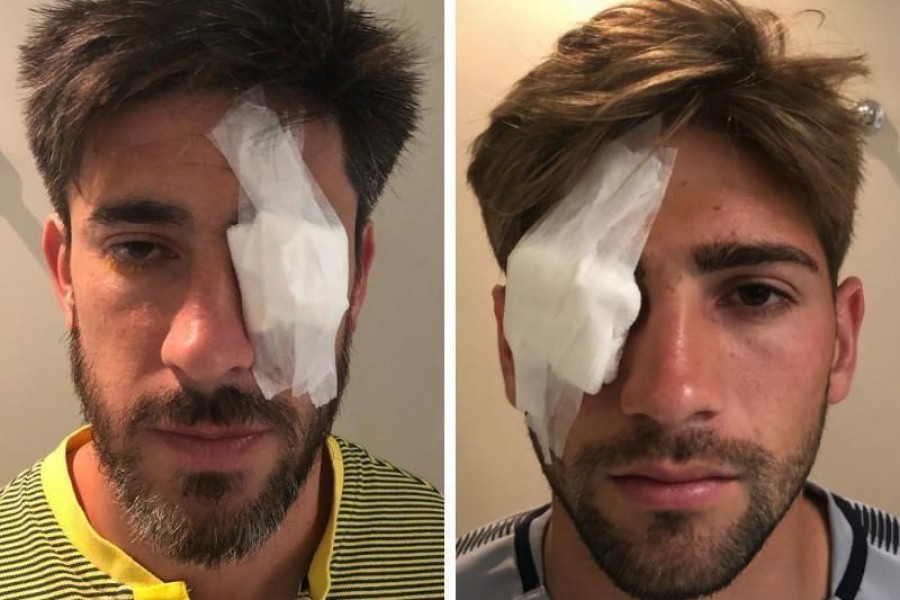 I due calciatori del Boca Juniors feriti
